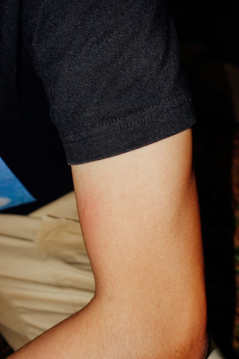 Tattoo infection signs: red, raised patch of skin on the arm